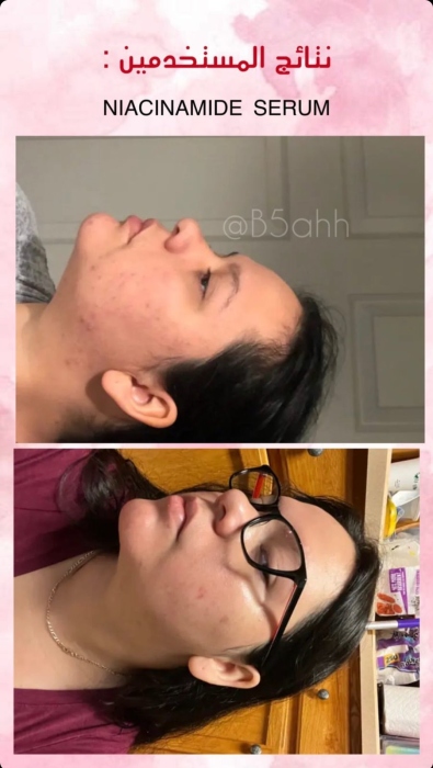 Good molecules, Niacinamide Serum